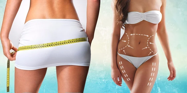Bezbolestná liposukce 3. generace s přístrojovou lymfodrenáží