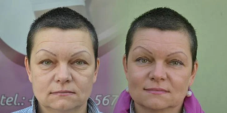 Nechte se hýčkat: balíček faceliftingu a zeštíhlujících procedur