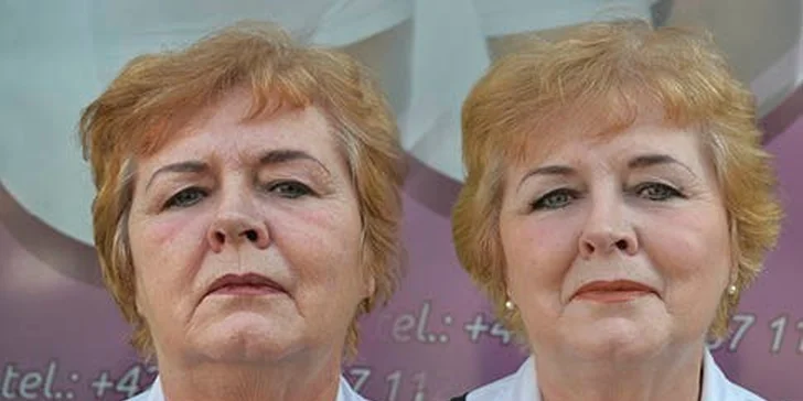 Nechte se hýčkat: balíček faceliftingu a zeštíhlujících procedur