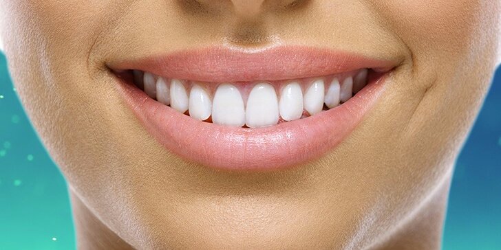 Dentální hygiena pro krásný usměv v Dental Beauty