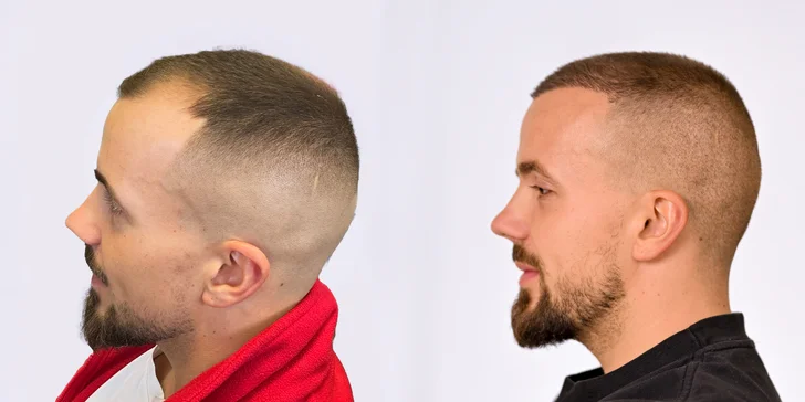 Pre a po - viac ako 8 mesiacov
