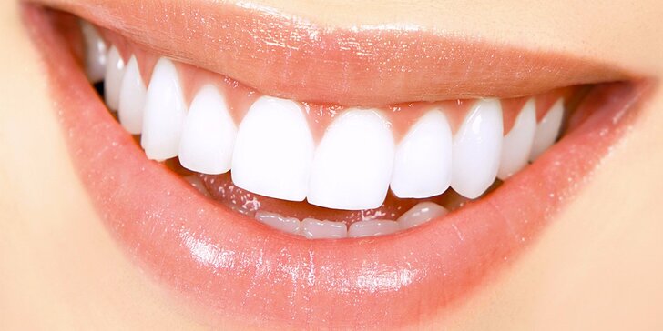 Ordinační bělení zubů moderním gelovým systémem Whiteness HP Blue