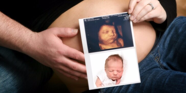 4D ultrazvuk vašeho miminka – záznam na CD či flashku