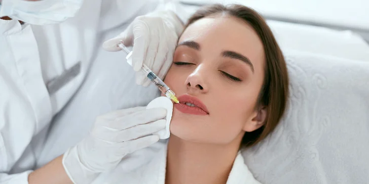 Výplň pier kyselinou hyalurónovou metódou Stripp Lips aj s korekciou vybranej oblasti tváre