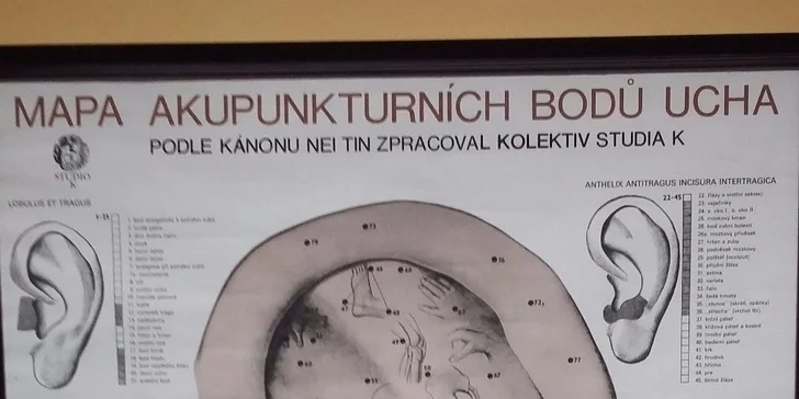 Akupunktura na hubnutí nebo proti kouření