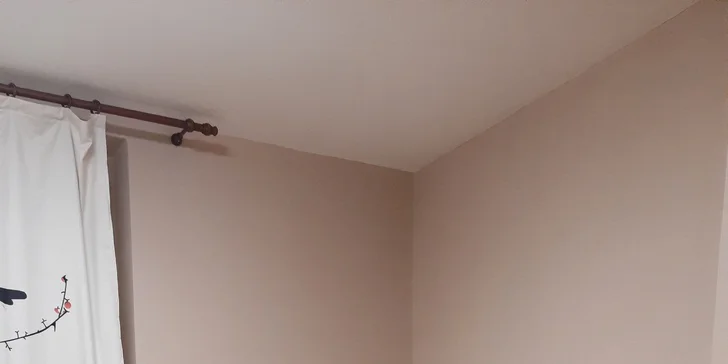  Po zákroku je důležité dopřát pokožce dostatek vody.