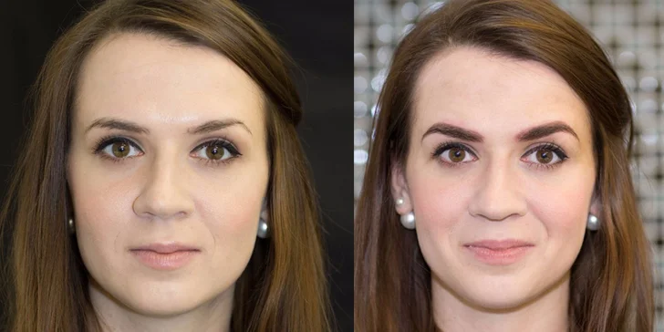 Permanentní rekonstrukce obočí technikou 6D