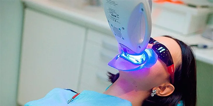 Ordinační bělení zubů s možností kompletní dentální hygieny