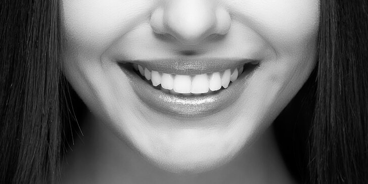 Neperoxidové bělení zubů včetně remineralizace zubní skloviny