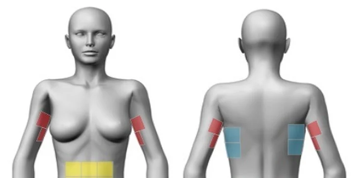 Lipodestrukce přístrojem Liposonix: 1 nebo 10 shotů v partii dle výběru