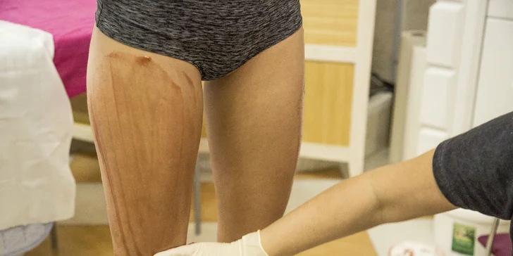 Tvarování postavy s podtlakovou lymfatickou masáží Vacupress s termozábalem