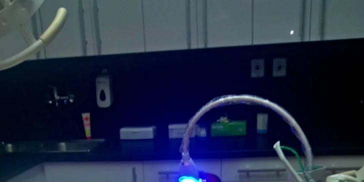 Ordinační bělení gelem a modrým laserovým světlem + dárek pro domácí péči