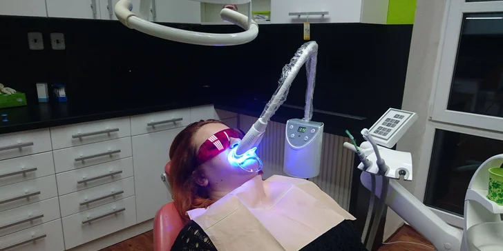 Ordinační bělení gelem a modrým laserovým světlem + bělicí pero pro domácí péči