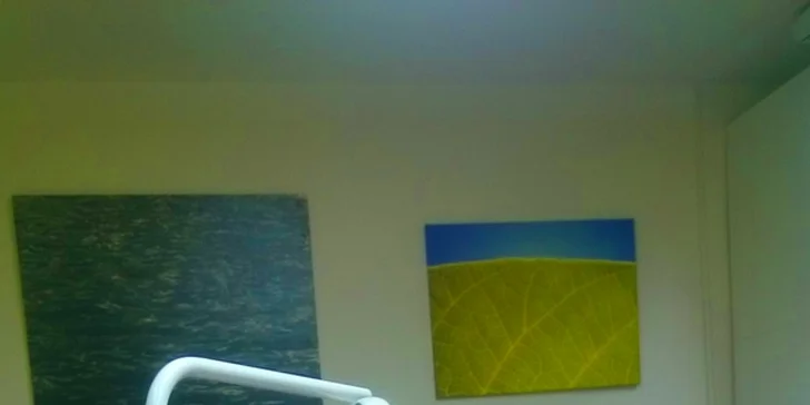 Ordinační bělení gelem a modrým laserovým světlem + dárek pro domácí péči