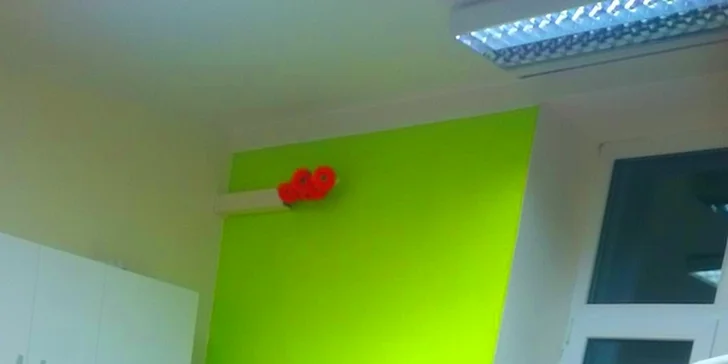 Ordinační bělení gelem a modrým laserovým světlem + dárek pro domácí péči