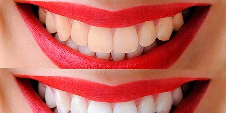 Ordinační bělení zubů s kompletní dentální hygieny vč. AirFlow