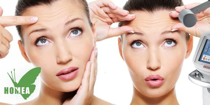 899 Kč za omlazující laserový peeling pleti na klinice Homea v Pardubicích. Nejžádanější kosmetický zákrok s okamžitými výsledky a se slevou 55 %.