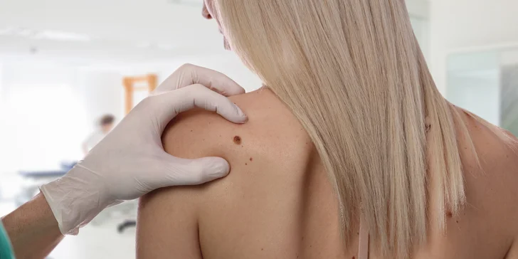 Okamžité odstranění fibrom–hemangiomu a výrustků metodou T-Away