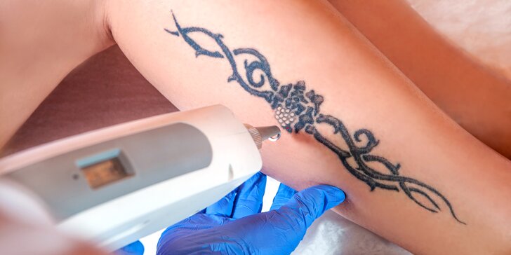 Odstranění tetování Q-switch laserem v profi studiu: udělejte si místo na nový kus