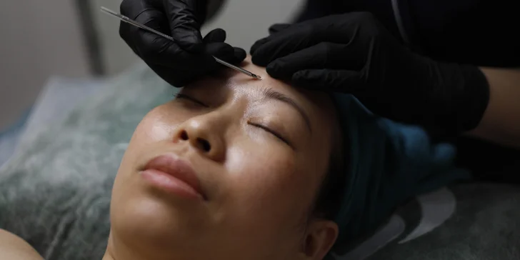Chemický peeling pomáhá zmírňovat vrásky, pigmentové skvrny i jizvy po akné.