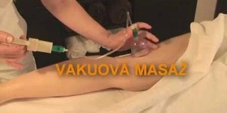 50minutová vakuová anticelulitidní masáž ve Studiu Pretty-up