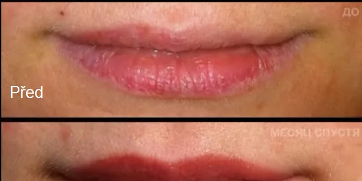 Mikropigmentace obočí (vláskování) nebo rtů včetně probarvení
