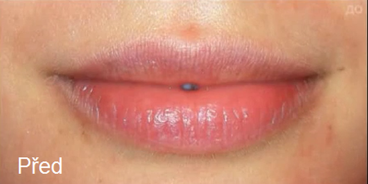 Mikropigmentace obočí (vláskování) nebo rtů včetně probarvení