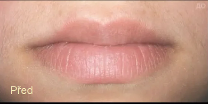 Mikropigmentace obočí (vláskování) nebo rtů včetně probarvení