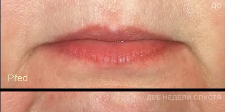 Mikropigmentace obočí (vláskování) nebo rtů včetně probarvení
