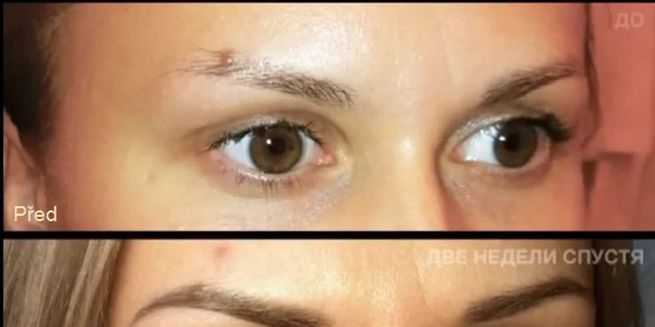 Mikropigmentace obočí (vláskování) nebo rtů včetně probarvení