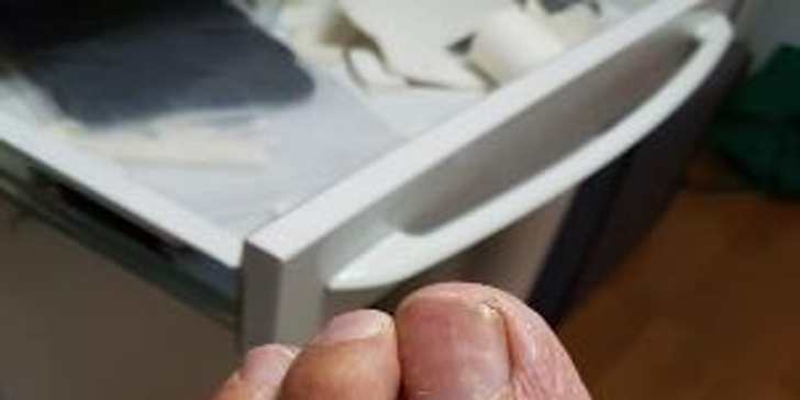 Ošetření mykózy na nehtech rukou nebo nohou výkonným laserem