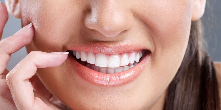 Kosmetické zesvětlení zubů bez použití peroxidu: 3 aplikace pro přirozený odstín