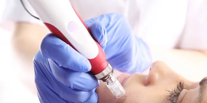 Dejte sbohem vráskám a jiným nedostatkům pleti pomocí mikrojehličkování