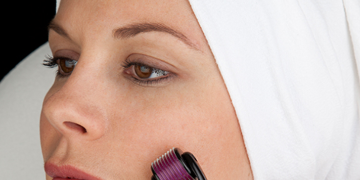 Ošetření obličeje pomocí mezoterapie dermarollerem a zapracování kolagenu