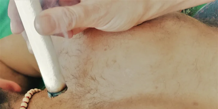 Tato léčebná metoda tradiční čínské medicíny spočívá v nahřívání či požehování akupunkturních bodů těla.