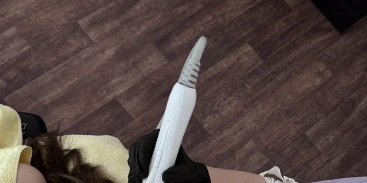 Mezoterapie zlepšuje výživu vlasů a napomáhá i při nadměrné tvorbě mazu nebo lupů. 
