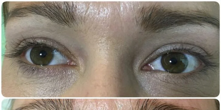Řasy až do nebe: revoluční lash lifting s kúrou na řasy lash botox