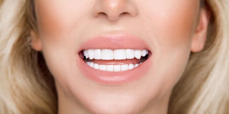 Zářivý úsměv bez peroxidu: 1–3 procedury bělení pomocí metody Star White