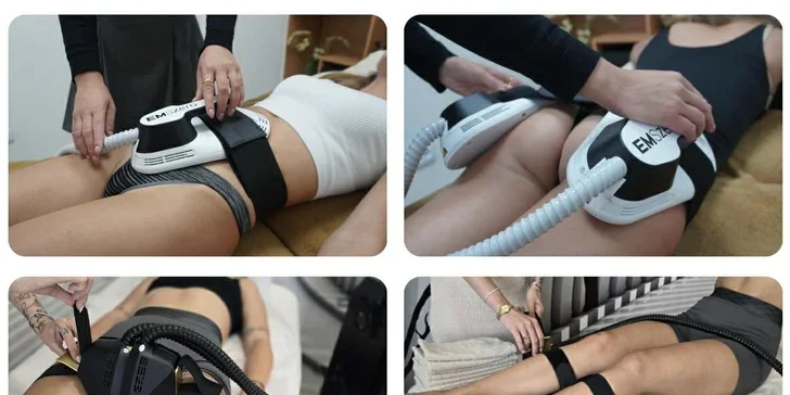 Elektromagnetické impulzy aktivují až 90 % svalové hmoty, zatímco kombinace s radiofrekvencí zvyšuje efekt redukce tukových zásob a podporuje zpevnění kůže.