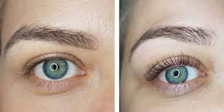 Jako mrkací panenka i s přírodními řasami: Revoluční technika Lash Lifting a Botox