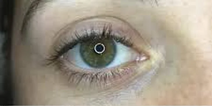 Jako mrkací panenka i s přírodními řasami: Revoluční technika Lash Lifting a Botox