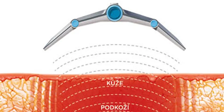 ošetření je možné provést i na objemnější partie díky veliké hlavici