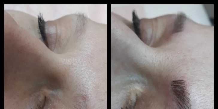 Zvýraznění a zhuštění obočí přirozeně vypadající metodou: 3D microblading