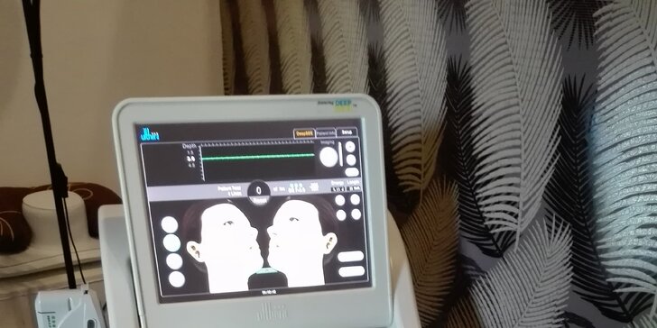 Ultrazvukové ošetření HIFU Ultherapy pro krásné tělo i obličej