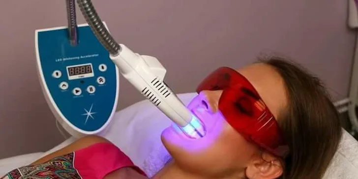 Zářivý úsměv snadno a šetrně: neperoxidové bělení zubů
