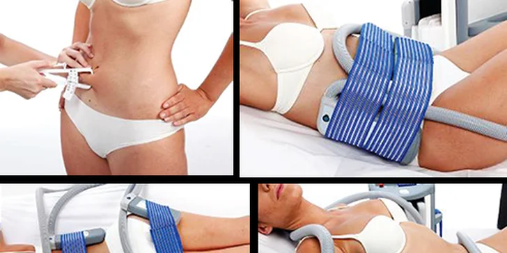 Fit do plavek: ošetření těla kryoterapií + lymfodrenáž k tomu