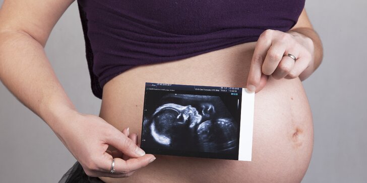 Profesionální těhotenské focení v ateliéru: 5 upravených fotografií v elektronické podobě