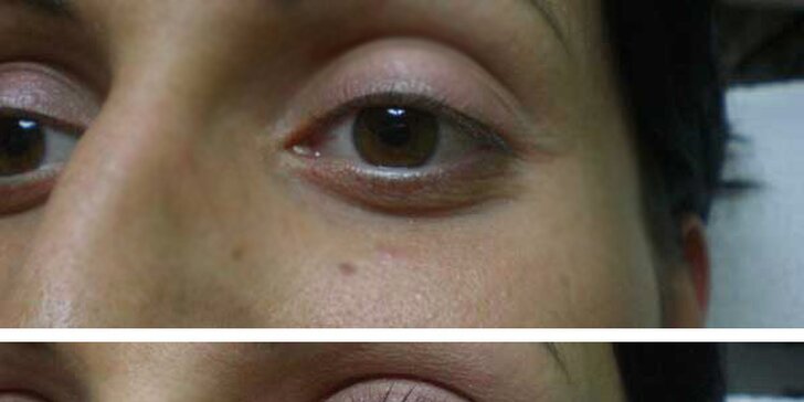Permanentní make-up očních linek nebo vláskování obočí