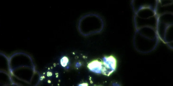 Detail protoplastu  s kvasinkami - typické pro urogenitální nemoci - zvětšeno 1000x