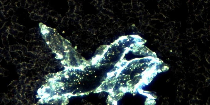 Obrovský protoplast s nahromaděním těžkých kovů - zvětšeno 200x